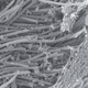 An image of SARS-COV-2 virions infecting the cells that line the airways of our lungs. The image is taken at 1 micrometer magnification.